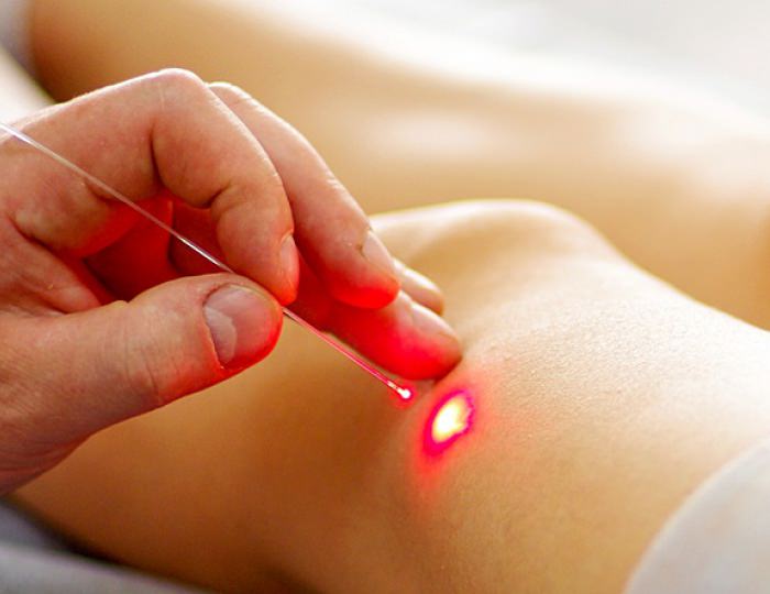 Магнито- и лазеротерапия - Пансионат «ФЕЯ-2 SUNBEACH RESORT»